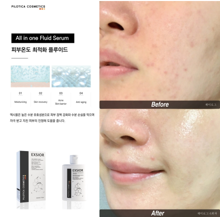 장벽개선] 필로티카 엑시올 플루이드 80ml
