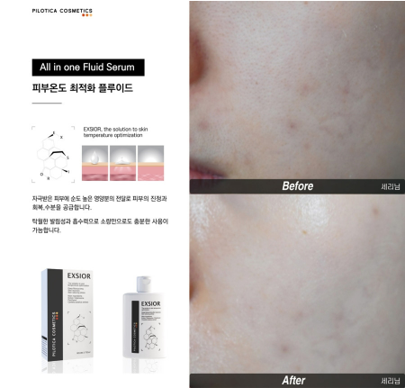 장벽개선] 필로티카 엑시올 플루이드 80ml